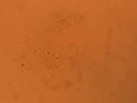 Echiniscus africanus image