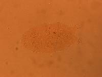 Echiniscus africanus image
