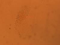 Echiniscus africanus image