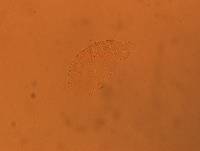 Echiniscus africanus image