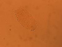 Echiniscus africanus image