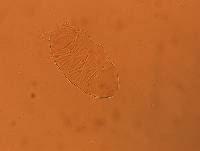 Echiniscus africanus image