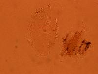 Echiniscus africanus image