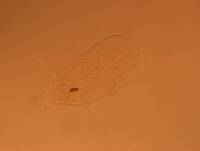 Echiniscus africanus image