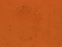 Echiniscus africanus image