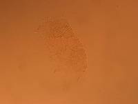 Echiniscus africanus image