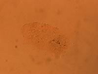 Echiniscus africanus image