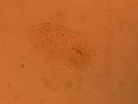 Echiniscus africanus image