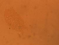 Echiniscus africanus image
