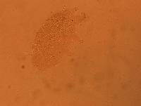 Echiniscus africanus image