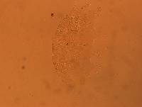 Echiniscus africanus image