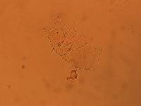Echiniscus africanus image