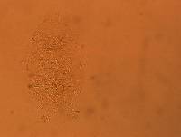 Echiniscus africanus image