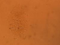 Echiniscus africanus image