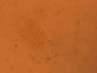 Echiniscus africanus image