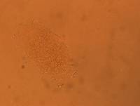 Echiniscus africanus image