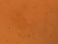 Echiniscus africanus image