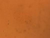 Echiniscus africanus image