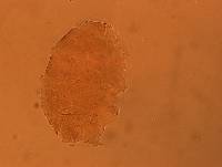 Echiniscus aliquantillus image