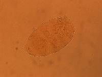 Echiniscus aliquantillus image