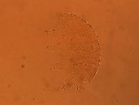 Echiniscus aliquantillus image
