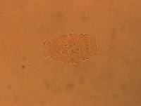 Echiniscus aliquantillus image