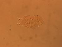 Echiniscus aliquantillus image