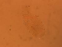 Echiniscus aliquantillus image
