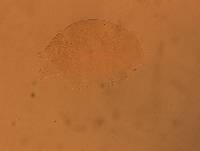 Echiniscus aliquantillus image