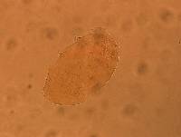 Echiniscus aliquantillus image