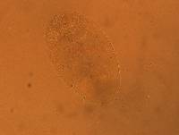 Echiniscus aliquantillus image