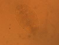 Echiniscus aliquantillus image