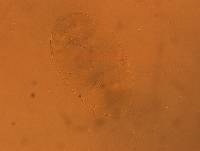 Echiniscus aliquantillus image