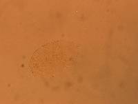 Echiniscus aliquantillus image