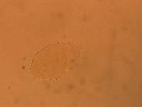 Echiniscus aliquantillus image