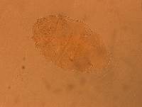 Echiniscus aliquantillus image