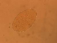 Echiniscus aliquantillus image