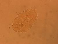 Echiniscus aliquantillus image