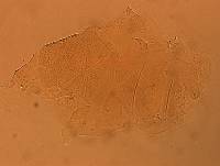 Echiniscus aliquantillus image