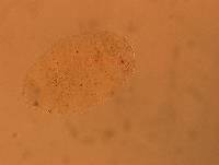 Echiniscus aliquantillus image