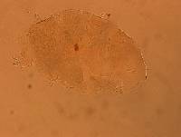 Echiniscus aliquantillus image