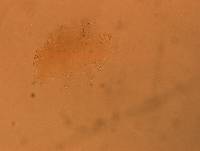 Echiniscus angolensis image