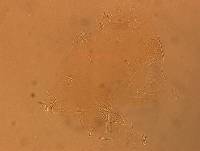 Echiniscus angolensis image
