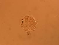Macrobiotus hufelandi image