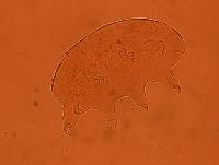 Echiniscus baius image