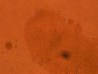 Echiniscus kerguelensis image