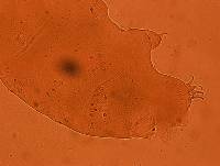 Echiniscus kerguelensis image
