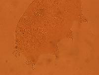 Echiniscus viridis image