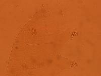 Echiniscus reticulatus image
