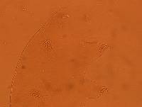 Echiniscus reticulatus image